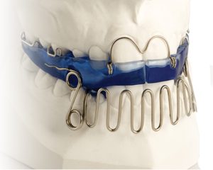 Gyermek kivehető fogszabályozó — Smile Centrum
