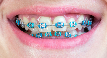 keszulek_hagyomanyos