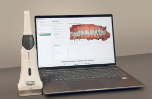 Fogszabályozó szakorvos vagy fogorvos — Smile Centrum Miskolc